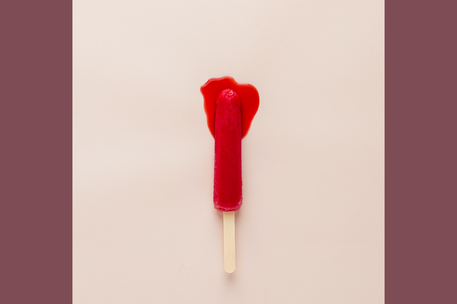 Syndrome de congestion pelvienne : Symptômes, Traitements et Témoignages