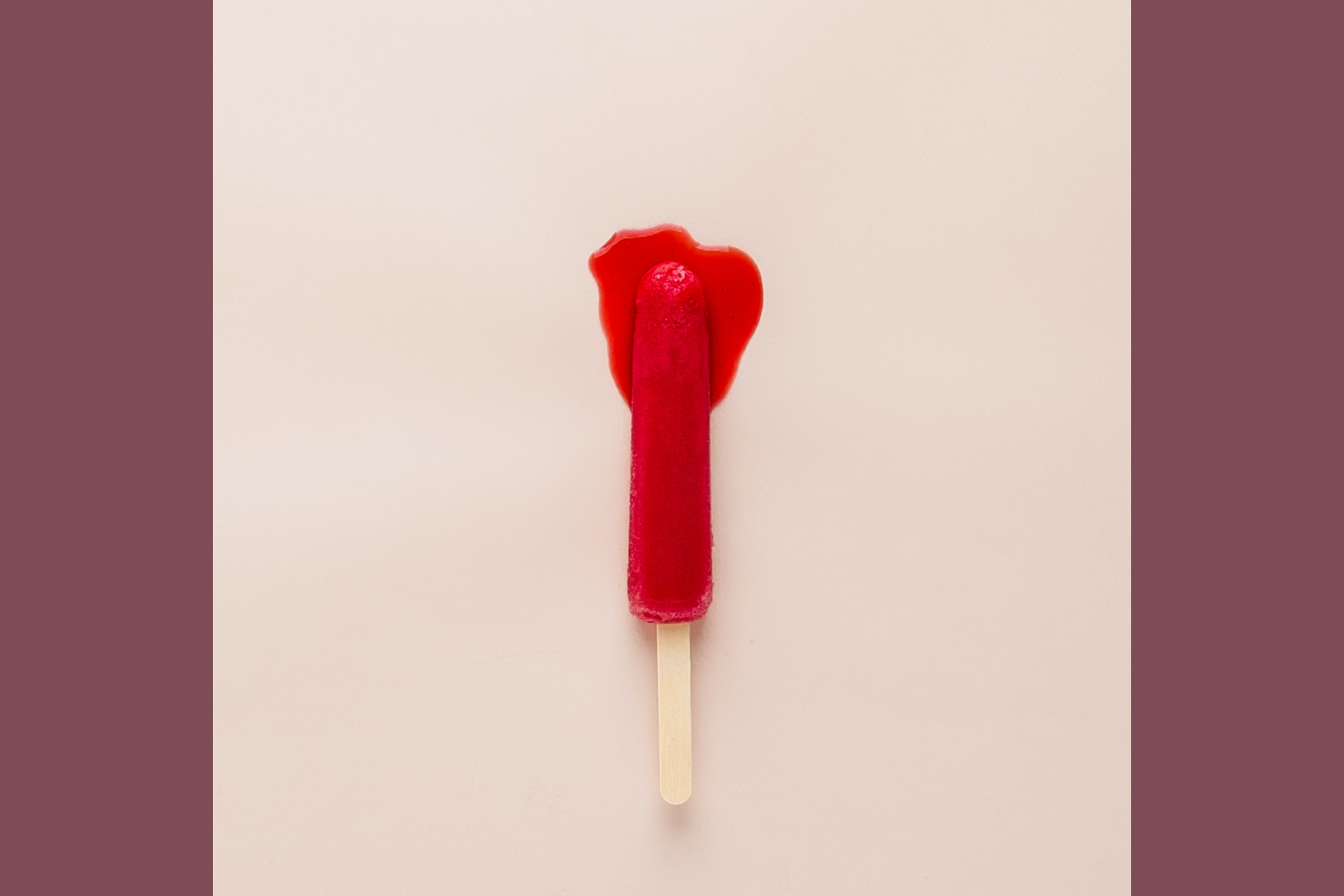 Syndrome de congestion pelvienne : Symptômes, Traitements et Témoignages